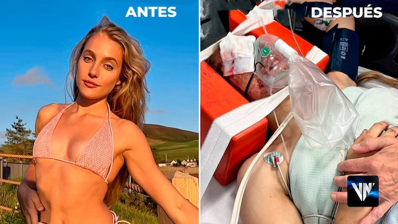 Modelo de OnlyFans pasó una semana inconsciente tras accidente con una paloma